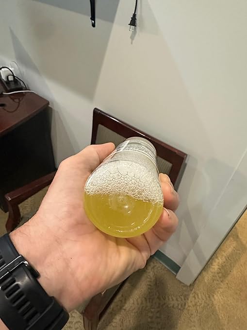 Mosquito Magician Liquid Concentrate - Kills Mosquitoes, Fleas, & Fire Ants, Use with Pump or Backpack Sprayers, Foggers, or Automatic Misting Machines, Ideal for Yards, Lawns, Patios, 16 OZ - Mint